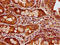 Papillary thyroid carcinoma-encoded protein antibody, CSB-PA623068LA01HU, Cusabio, Immunohistochemistry frozen image 