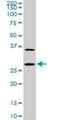 Cbp/P300 Interacting Transactivator With Glu/Asp Rich Carboxy-Terminal Domain 1 antibody, H00004435-M04, Novus Biologicals, Western Blot image 