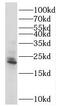 RAB18, Member RAS Oncogene Family antibody, FNab06998, FineTest, Western Blot image 