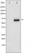 Ribosomal Protein S6 Kinase B1 antibody, TA325829, Origene, Western Blot image 