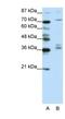 A-Kinase Anchoring Protein 9 antibody, NBP1-80308, Novus Biologicals, Western Blot image 
