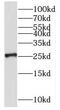 Ring Finger Protein 151 antibody, FNab07341, FineTest, Western Blot image 