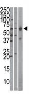 Karyopherin Subunit Alpha 4 antibody, AP11806PU-N, Origene, Western Blot image 
