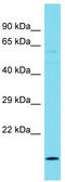 Ankyrin Repeat Domain 22 antibody, TA333515, Origene, Western Blot image 
