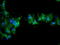 N-Ribosyldihydronicotinamide:Quinone Reductase 2 antibody, TA504782, Origene, Immunofluorescence image 