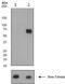 PTPN11 antibody, ab62322, Abcam, Western Blot image 