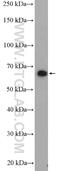 Nuclear Receptor Subfamily 4 Group A Member 2 antibody, 10975-2-AP, Proteintech Group, Western Blot image 