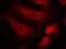 Signal Transducer And Activator Of Transcription 1 antibody, GTX50217, GeneTex, Immunofluorescence image 