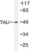 PHF-tau antibody, AP06341PU-N, Origene, Western Blot image 
