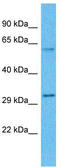 Zinc Finger DHHC-Type Containing 19 antibody, TA329331, Origene, Western Blot image 