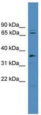 SURP And G-Patch Domain Containing 1 antibody, TA344019, Origene, Western Blot image 