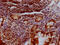 Kruppel Like Factor 4 antibody, CSB-RA194949A0HU, Cusabio, Immunohistochemistry paraffin image 