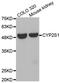 Cytochrome P450 Family 2 Subfamily S Member 1 antibody, STJ26287, St John
