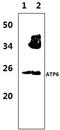 Mitochondrially Encoded ATP Synthase Membrane Subunit 6 antibody, A33471, Boster Biological Technology, Western Blot image 