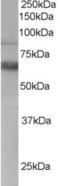 ANTXR Cell Adhesion Molecule 1 antibody, orb18759, Biorbyt, Western Blot image 