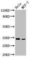 NFKB Inhibitor Delta antibody, LS-C397563, Lifespan Biosciences, Western Blot image 