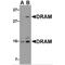 DNA Damage Regulated Autophagy Modulator 1 antibody, MBS151103, MyBioSource, Western Blot image 