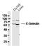 Selectin E antibody, GTX17548, GeneTex, Western Blot image 