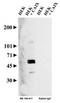 Carbonic Anhydrase 9 antibody, NB100-417B, Novus Biologicals, Western Blot image 