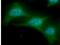 Ubiquitin Conjugating Enzyme E2 L6 antibody, NBP1-04351, Novus Biologicals, Immunofluorescence image 