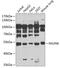 NOP2/Sun RNA Methyltransferase 6 antibody, 14-996, ProSci, Western Blot image 