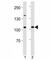 Telomerase Reverse Transcriptase antibody, F43527-0.4ML, NSJ Bioreagents, Immunohistochemistry paraffin image 