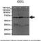 Rho GDP-dissociation inhibitor 1 antibody, TA330010, Origene, Western Blot image 