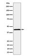 Natural Cytotoxicity Triggering Receptor 2 antibody, M05962-1, Boster Biological Technology, Western Blot image 