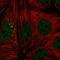 Suppression Of Tumorigenicity 14 antibody, HPA047014, Atlas Antibodies, Immunofluorescence image 