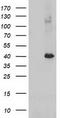 Alcohol Dehydrogenase 1B (Class I), Beta Polypeptide antibody, CF502775, Origene, Western Blot image 