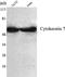 Keratin 7 antibody, STJ98484, St John