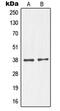 NK2 Homeobox 1 antibody, MBS820795, MyBioSource, Western Blot image 