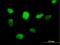Zinc Finger And BTB Domain Containing 14 antibody, H00007541-B01P, Novus Biologicals, Immunocytochemistry image 