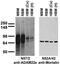 ADAM Metallopeptidase Domain 22 antibody, 75-093, Antibodies Incorporated, Western Blot image 