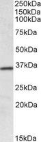 Homeobox protein Hox-A4 antibody, GTX88095, GeneTex, Western Blot image 