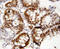 Forkhead Box P1 antibody, LS-C312749, Lifespan Biosciences, Immunohistochemistry paraffin image 