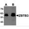 Zinc Finger And BTB Domain Containing 3 antibody, MBS150761, MyBioSource, Western Blot image 