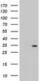 Translocase Of Outer Mitochondrial Membrane 34 antibody, CF503184, Origene, Western Blot image 