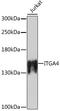 CD49D antibody, A0696, ABclonal Technology, Western Blot image 