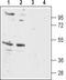 Melanocortin 5 Receptor antibody, TA328873, Origene, Western Blot image 
