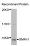Gonadotropin Releasing Hormone 1 antibody, TA332797, Origene, Western Blot image 