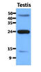 Fatty Acid Binding Protein 9 antibody, AM50091PU-N, Origene, Western Blot image 