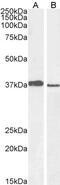 Polycomb group RING finger protein 2 antibody, PA5-18163, Invitrogen Antibodies, Western Blot image 
