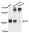 Desmocollin 1 antibody, A03478, Boster Biological Technology, Western Blot image 