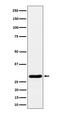 Dscr1 antibody, M02795-1, Boster Biological Technology, Western Blot image 