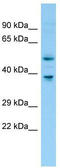 Farnesyltransferase, CAAX Box, Beta antibody, TA344328, Origene, Western Blot image 