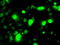 Replication Protein A2 antibody, LS-C114864, Lifespan Biosciences, Immunofluorescence image 
