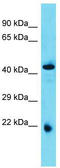 Abhydrolase Domain Containing 4 antibody, TA344709, Origene, Western Blot image 
