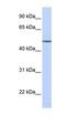 Adrenoceptor Beta 1 antibody, orb329873, Biorbyt, Western Blot image 