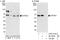 General Transcription Factor IIH Subunit 1 antibody, A303-515A, Bethyl Labs, Immunoprecipitation image 